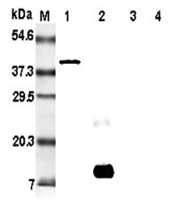 Western blot analysis of resistin using anti-Resistin (rat), mAb (RRES 07) at 1:5000 dilution. . 1: Rat resistin:Fc fusion protein. 2: Recombinant rat resistin protein (His-tagged). 3: Recombinant human resistin protein (His-tagged). 4: Recombinant mouse resistin protein (His-tagged).