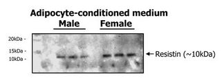 Immunoblot analysis of adipocyte-conditioned medium from human male and female with different Resistin expression levels using anti-Resistin (human), pAb . The molecular weight of Resistin is ~10kDa.