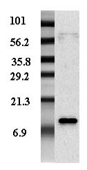 Western blot analysis of adipocyte-conditioned medium from human male and female with different expression levels using anti-Resistin (human), pAb .