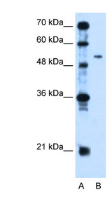PSG1 antibody LS-C40378 Western blot of Jurkat lysate.