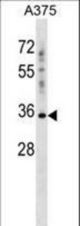 PSG2 Antibody western blot of A375 cell line lysates (35 ug/lane). The PSG2 antibody detected the PSG2 protein (arrow).