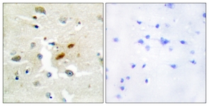 IHC of paraffin-embedded human brain tissue, using DNA Polymerase zeta Antibody. The picture on the right is treated with the synthesized peptide.