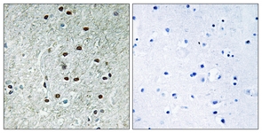 IHC of paraffin-embedded human brain, using REXO1 Antibody. The picture on the right is treated with the synthesized peptide.