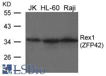 Western blot of extracts from JK, HL-60 and Raji cells using Rex1 (ZFP42) antibody.