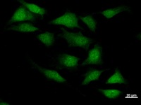 Immunostaining analysis in HeLa cells. HeLa cells were fixed with 4% paraformaldehyde and permeabilized with 0.1% Triton X-100 in PBS. The cells were immunostained with anti-REXO2 mAb.