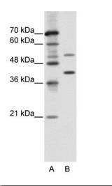 A: Marker, B: Jurkat Cell Lysate