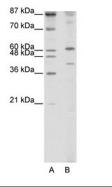 A: Marker, B: Jurkat Cell Lysate