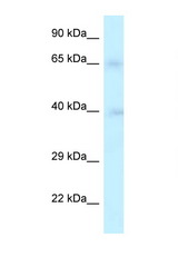 RFC2 antibody LS-C145336 Western blot of 3 Cell lysate. Antibody concentration 1 ug/ml.
