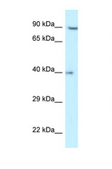 RFC2 antibody LS-C145337 Western blot of HCT15 Cell lysate. Antibody concentration 1 ug/ml.