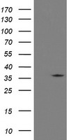HEK293T cells were transfected with the pCMV6-ENTRY control (Left lane) or pCMV6-ENTRY RFC2 (Right lane) cDNA for 48 hrs and lysed. Equivalent amounts of cell lysates (5 ug per lane) were separated by SDS-PAGE and immunoblotted with anti-RFC2.