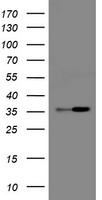 HEK293T cells were transfected with the pCMV6-ENTRY control (Left lane) or pCMV6-ENTRY RFC2 (Right lane) cDNA for 48 hrs and lysed. Equivalent amounts of cell lysates (5 ug per lane) were separated by SDS-PAGE and immunoblotted with anti-RFC2.