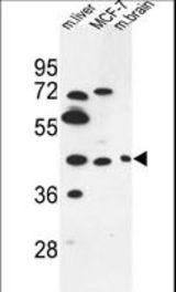 PSG3 Antibody western blot of MCF-7 cell line and mouse liver,brain tissue lysates (35 ug/lane). The PSG3 antibody detected the PSG3 protein (arrow).