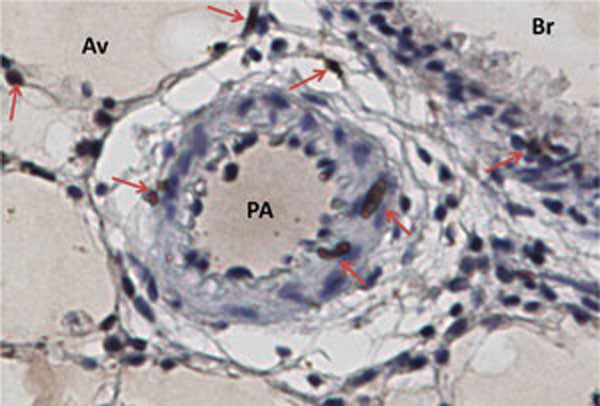 Rat lung, taken with 40x objective. Immunohistochemistry with RFC2 Antibody , 1:200 dilution,counter stained with Hematoxylin. Positive cells identified with arrows. Av-Alveoli, Br-Bronchus, Pa-Pulmonary Artery. (Provided by Hirotaka Ata,University of South Alabama, Dept of Biochem and Mol Biol)