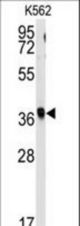 Western blot of anti-RFC2 Antibody in K562 cell line lysates (35 ug/lane). RFC2(arrow) was detected using the purified antibody.