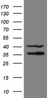 HEK293T cells were transfected with the pCMV6-ENTRY control (Left lane) or pCMV6-ENTRY RFC2 (Right lane) cDNA for 48 hrs and lysed. Equivalent amounts of cell lysates (5 ug per lane) were separated by SDS-PAGE and immunoblotted with anti-RFC2.