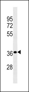 PSG4 Antibody western blot of MDA-MB453 cell line lysates (35 ug/lane). The PSG4 antibody detected the PSG4 protein (arrow).