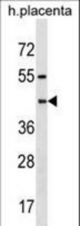 PSG6 Antibody western blot of human placenta tissue lysates (35 ug/lane). The PSG6 antibody detected the PSG6 protein (arrow).