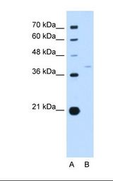 Lane A: Marker. Lane B: HepG2 cell lysate. Antibody concentration: 1.0 ug/ml. Gel concentration: 12%.