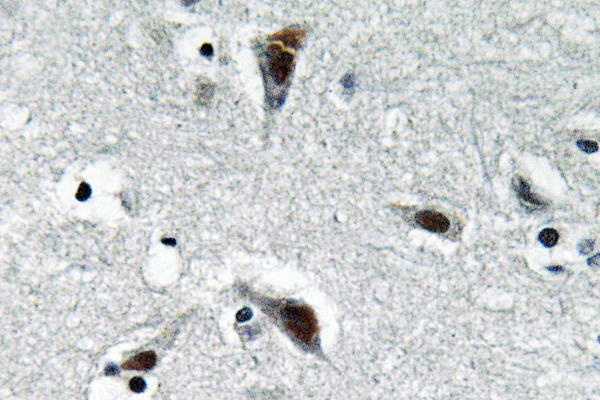 IHC of RFC3 (L227) pAb in paraffin-embedded human brain tissue.