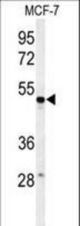 Western blot of PSG7 Antibody in MCF-7 cell line lysates (35 ug/lane). PSG7 (arrow) was detected using the purified antibody.