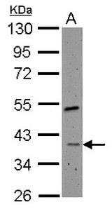 Sample (30 ug of whole cell lysate) A: HeLa nucleus 10% SDS PAGE RFC4 antibody diluted at 1:500