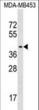 PSG9 Antibody western blot of MDA-MB453 cell line lysates (35 ug/lane). The PSG9 antibody detected the PSG9 protein (arrow).