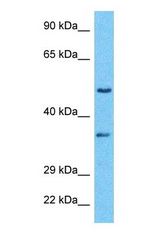 Western blot of RFC5 Antibody with human HeLa Whole Cell lysate.