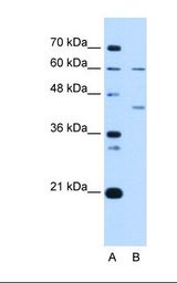 Lane A: Marker. Lane B: Jurkat cell lysate. Antibody concentration: 1.0 ug/ml. Gel concentration: 12%.