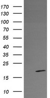 HEK293T cells were transfected with the pCMV6-ENTRY control (Left lane) or pCMV6-ENTRY RFESD (Right lane) cDNA for 48 hrs and lysed. Equivalent amounts of cell lysates (5 ug per lane) were separated by SDS-PAGE and immunoblotted with anti-RFESD.