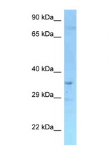 RFFL antibody LS-C146328 Western blot of Mouse Liver lysate. Antibody concentration 1 ug/ml.
