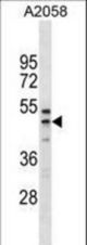 RFFL Antibody western blot of A2058 cell line lysates (35 ug/lane). The RFFL antibody detected the RFFL protein (arrow).
