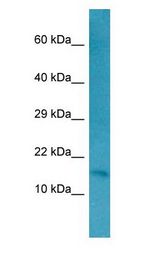 RFK antibody Western Blot of HepG2.