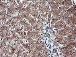 IHC of paraffin-embedded Human liver tissue using anti-RFPL3 mouse monoclonal antibody.