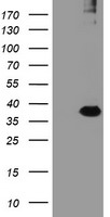 HEK293T cells were transfected with the pCMV6-ENTRY control (Left lane) or pCMV6-ENTRY RFPL3 (Right lane) cDNA for 48 hrs and lysed. Equivalent amounts of cell lysates (5 ug per lane) were separated by SDS-PAGE and immunoblotted with anti-RFPL3.