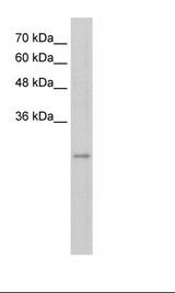 Jurkat Cell Lysate