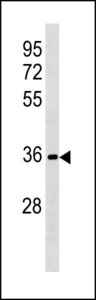 RFPL3 Antibody western blot of HL-60 cell line lysates (35 ug/lane). The RFPL3 antibody detected the RFPL3 protein (arrow).