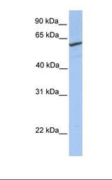HepG2 cell lysate. Antibody concentration: 1.0 ug/ml. Gel concentration: 12%.