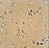 RFT1 antibody immunohistochemistry of formalin-fixed and paraffin-embedded human brain tissue followed by peroxidase-conjugated secondary antibody and DAB staining.