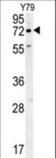 RFT1 Antibody western blot of Y79 cell line lysates (35 ug/lane). The RFT1 antibody detected the RFT1 protein (arrow).
