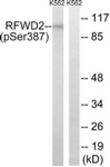 Western blot of extracts from K562 cells treated with UV 15', using RFWD2 (Phospho-Ser387) Antibody. The lane on the right was incubated with synthetic peptide.