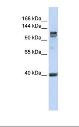 MCF7 cell lysate. Antibody concentration: 1.0 ug/ml. Gel concentration: 6-18%.