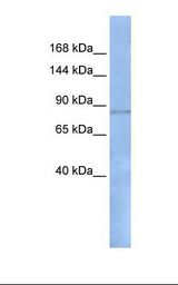 293T cell lysate. Antibody concentration: 1.0 ug/ml. Gel concentration: 6-18%.