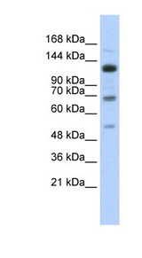 RFX1 antibody LS-C101681 Western blot of Transfected 293T cell lysate.