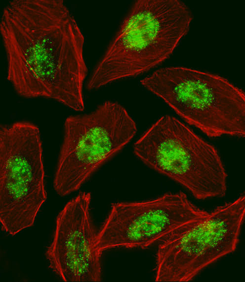 Fluorescent image of U251 cell stained with RFX1 Antibody. U251 cells were fixed with 4% PFA (20 min), permeabilized with Triton X-100 (0.1%, 10 min), then incubated with RFX1 primary antibody (1:25, 1 h at 37°C). For secondary antibody, Alexa Fluor 488 conjugated donkey anti-rabbit antibody (green) was used (1:400, 50 min at 37°C). Cytoplasmic actin was counterstained with Alexa Fluor 555 (red) conjugated Phalloidin (7units/ml, 1 h at 37°C). RFX1 immunoreactivity is localized to Nucleus significantly.