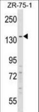 RFX1 Antibody western blot of ZR-75-1 cell line lysates (35 ug/lane). The RFX1 antibody detected the RFX1 protein (arrow).