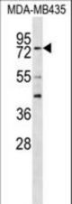 RFX3 Antibody western blot of MDA-MB435 cell line lysates (35 ug/lane). The RFX3 antibody detected the RFX3 protein (arrow).