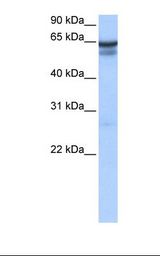 721_B cell lysate. Antibody concentration: 2.0 ug/ml. Gel concentration: 12%.