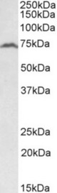 RFX5 antibody (2 ug/ml) staining of Daudi lysate (35 ug protein in RIPA buffer). Primary incubation was 1 hour. Detected by chemiluminescence.