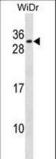 RFXANK Antibody western blot of WiDr cell line lysates (35 ug/lane). The RFXANK antibody detected the RFXANK protein (arrow).