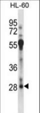 RFXAP Antibody western blot of HL-60 cell line lysates (35 ug/lane). The RFXAP antibody detected the RFXAP protein (arrow).